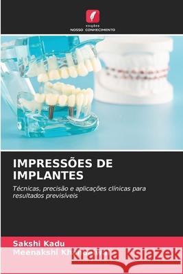 Impress?es de Implantes Sakshi Kadu Meenakshi Khandelwal 9786209443732 Edicoes Nosso Conhecimento - książka