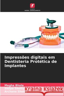 Impressões digitais em Dentisteria Protética de Implantes Bhola, Megha, Shetty, Shilpa, Shetty, Archana 9783330825796 Edições Nosso Conhecimento - książka