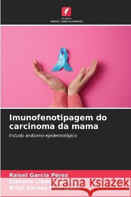 Imunofenotipagem do carcinoma da mama Raisel Garcia Perez Llanuris Llanes Garcia Ridyl Sarduy Rodriguez 9786205649183 Edicoes Nosso Conhecimento - książka