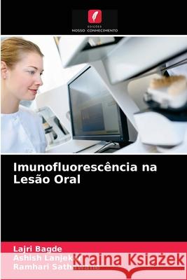 Imunofluorescência na Lesão Oral Lajri Bagde, Ashish Lanjekar, Ramhari Sathawane 9786203242652 Edicoes Nosso Conhecimento - książka