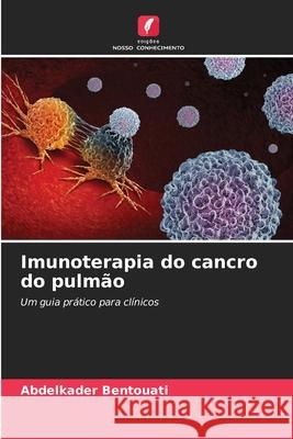 Imunoterapia do cancro do pulmão Bentouati, Abdelkader 9786206822639 Edições Nosso Conhecimento - książka