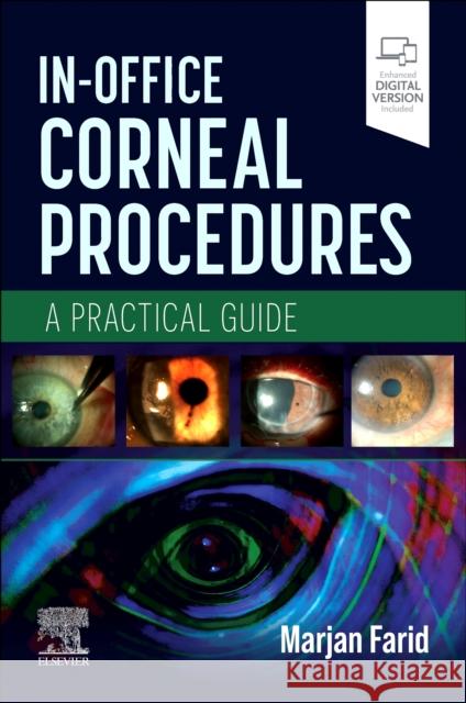 In-Office Corneal Procedures: A Practical Guide Marjan Farid 9780443125898 Elsevier Health Sciences - książka