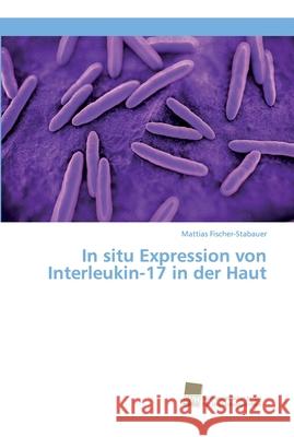 In situ Expression von Interleukin-17 in der Haut Fischer-Stabauer, Mattias 9783838151243 Südwestdeutscher Verlag für Hochschulschrifte - książka