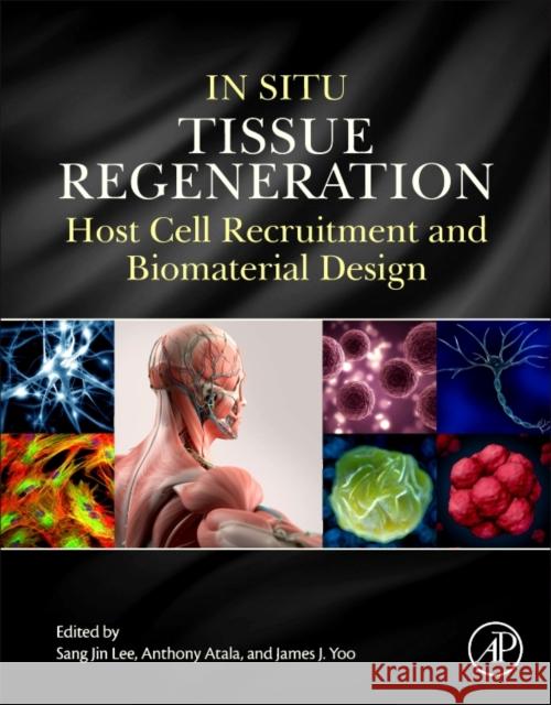 In Situ Tissue Regeneration: Host Cell Recruitment and Biomaterial Design Sang Jin Lee 9780128022252 ACADEMIC PRESS - książka