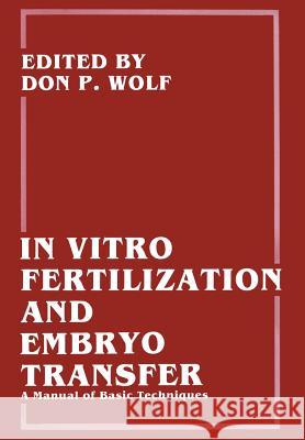 In Vitro Fertilization and Embryo Transfer: A Manual of Basic Techniques Bavister, Barry D. 9781461282884 Springer - książka