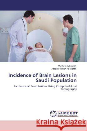 Incidence of Brain Lesions in Saudi Population Mustafa Alhassen, Atallh Fowzan Al-Motrfi 9783848442669 LAP Lambert Academic Publishing - książka