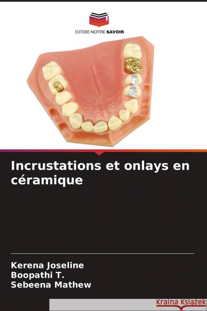 Incrustations et onlays en c?ramique Kerena Joseline Boopathi T Sebeena Mathew 9786206974857 Editions Notre Savoir - książka