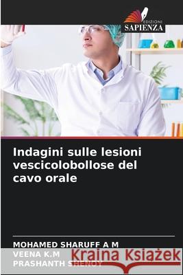 Indagini sulle lesioni vescicolobollose del cavo orale Mohamed Sharuff Veena K Prashanth Shenoy 9786207617418 Edizioni Sapienza - książka