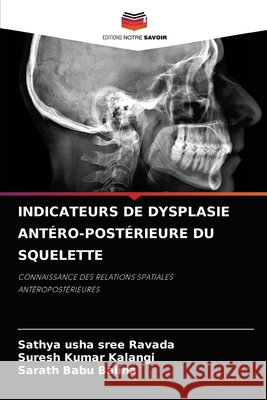 Indicateurs de Dysplasie Antéro-Postérieure Du Squelette Ravada, Sathya Usha Sree 9786204079004 Editions Notre Savoir - książka