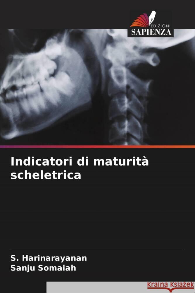 Indicatori di maturità scheletrica Harinarayanan, S., Somaiah, Sanju 9786207094554 Edizioni Sapienza - książka