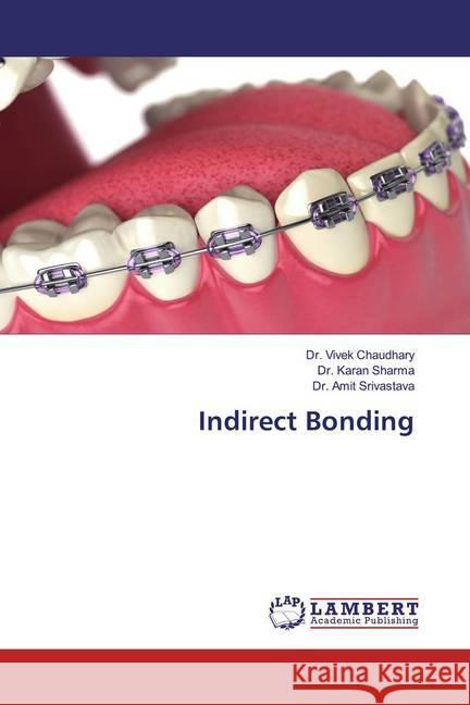 Indirect Bonding Chaudhary, Dr. Vivek; Sharma, Dr. Karan; Srivastava, Dr. Amit 9786139865789 LAP Lambert Academic Publishing - książka