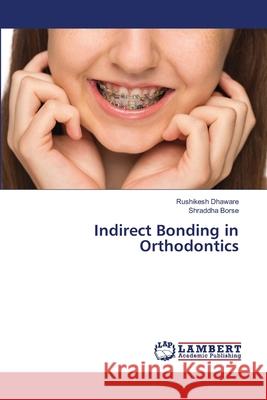 Indirect Bonding in Orthodontics Dhaware, Rushikesh, Borse, Shraddha 9786207453689 LAP Lambert Academic Publishing - książka