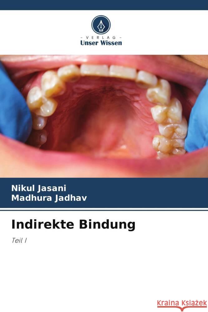 Indirekte Bindung Nikul Jasani Madhura Jadhav 9786208136123 Verlag Unser Wissen - książka