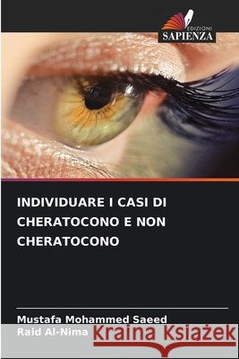 Individuare I Casi Di Cheratocono E Non Cheratocono Mohammed Saeed, Mustafa, Al-Nima, Raid 9786209945458 Edizioni Sapienza - książka