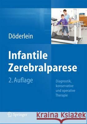 Infantile Zerebralparese: Diagnostik, Konservative Und Operative Therapie Döderlein, Leonhard 9783642353185 Springer - książka