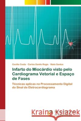Infarto do Miocárdio visto pelo Cardiograma Vetorial e Espaço de Fases Costa, Cecilia 9786202044509 Novas Edicioes Academicas - książka