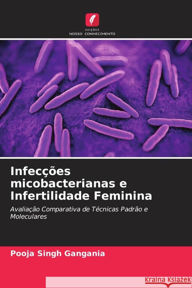 Infecções micobacterianas e Infertilidade Feminina Singh Gangania, Pooja 9786205088067 Edições Nosso Conhecimento - książka