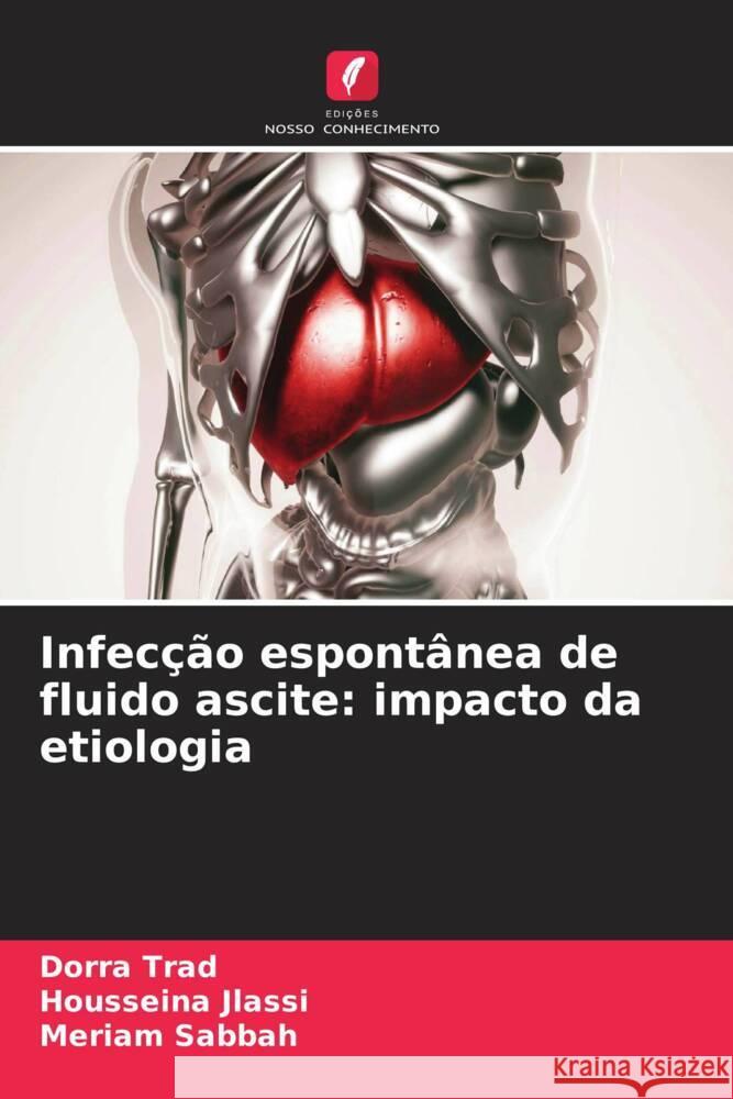 Infecção espontânea de fluido ascite: impacto da etiologia Trad, Dorra, Jlassi, Housseina, Sabbah, Mériam 9786204390260 Edicoes Nosso Conhecimento - książka