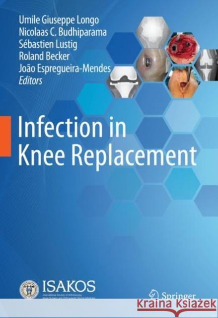 Infection in Knee Replacement Umile Giuseppe Longo Nicolaas C. Budhiparama Sebastien Lustig 9783030815523 Springer - książka