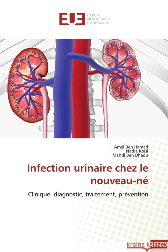 Infection urinaire chez le nouveau-né Ben Hamad, Amel, Kolsi, Nadia, Ben Dhaou, Mahdi 9786206725992 Éditions universitaires européennes - książka