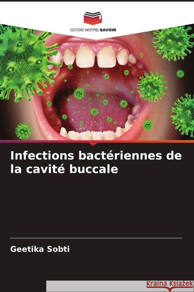 Infections bactériennes de la cavité buccale Sobti, Geetika 9786205572429 Editions Notre Savoir - książka