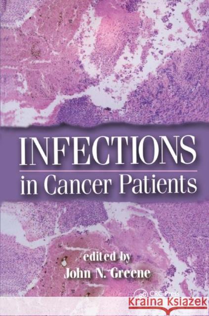 Infections in Cancer Patients  9780367394295 Taylor and Francis - książka