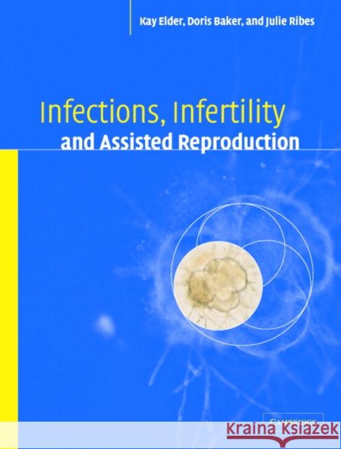 Infections, Infertility, and Assisted Reproduction Kay Elder (Bourn Hall Clinic, Cambridge), Doris J. Baker (University of Kentucky), Julie A. Ribes (University of Kentuck 9780521819107 Cambridge University Press - książka