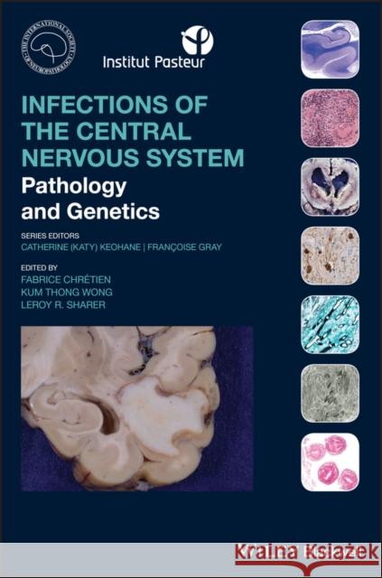 Infections of the Central Nervous System: Pathology and Genetics Chretien, Fabrice 9781119467762 Wiley-Blackwell - książka