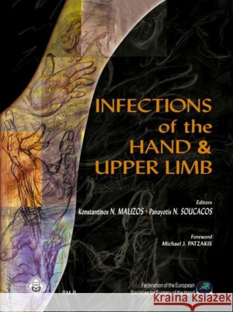 Infections of the Hand and Upper Limb Konstantinos Malizos 9789603995937 Broken Hill Medical - książka