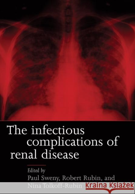 Infectious Complications of Renal Disease Herman Melville Paul Sweny Nina Tolkoff-Rubin 9780192632944 Oxford University Press, USA - książka