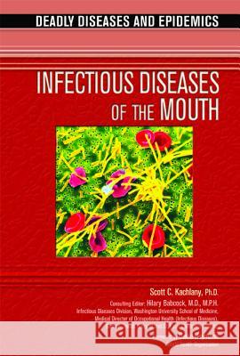 Infectious Diseases of the Mouth Scott C. Kachlany 9780791092422 Chelsea House Publications - książka