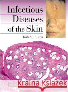 Infectious Diseases of the Skin Dirk Elston 9781840761078 MANSON PUBLISHING LTD - książka