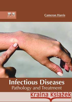 Infectious Diseases: Pathology and Treatment Cameron Harris 9781632425508 Foster Academics - książka