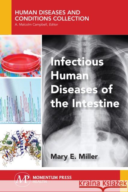 Infectious Human Diseases of the Intestine Mary E. Miller 9781944749873 Momentum Press - książka