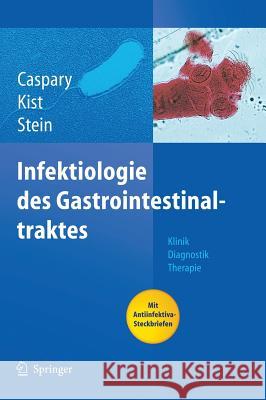 Infektiologie des Gastrointestinaltraktes: Klinik Diagnostik Therapie Caspary, Wolfgang F. 9783540413592 Springer, Berlin - książka