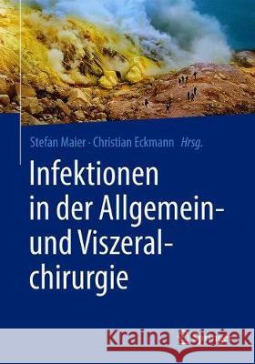 Infektionen in Der Allgemein- Und Viszeralchirurgie Stefan Maier Christian Eckmann 9783662625071 Springer - książka