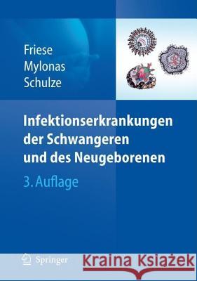 Infektionserkrankungen Der Schwangeren Und Des Neugeborenen Friese, Klaus 9783540783244 Springer - książka