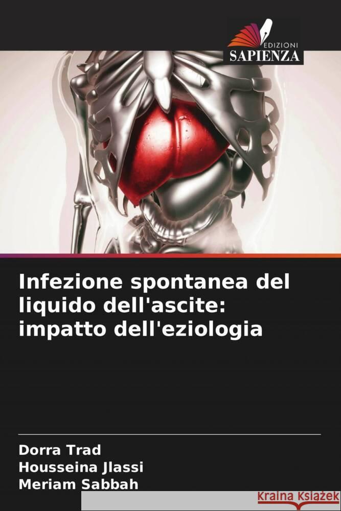 Infezione spontanea del liquido dell'ascite: impatto dell'eziologia Trad, Dorra, Jlassi, Housseina, Sabbah, Mériam 9786204390253 Edizioni Sapienza - książka