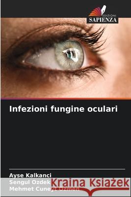 Infezioni fungine oculari Kalkanci, Ayse, Ozdek, Sengul, Ozmen, Mehmet Cuneyt 9786209378386 Edizioni Sapienza - książka