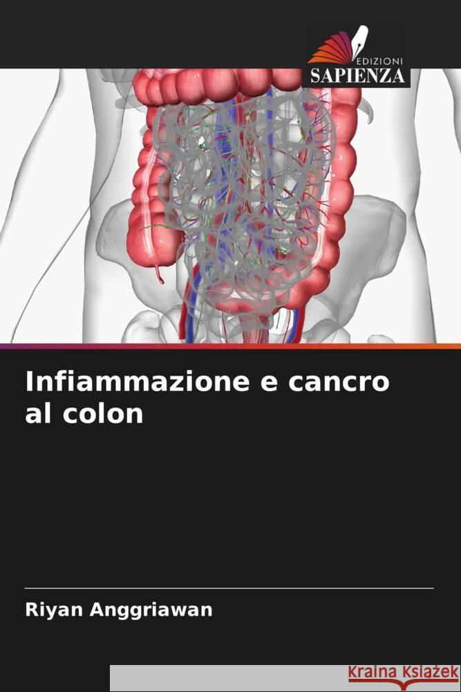 Infiammazione e cancro al colon Riyan Anggriawan 9786206620419 Edizioni Sapienza - książka