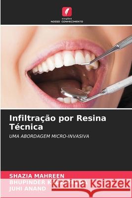 Infiltração por Resina Técnica Shazia Mahreen, Bhupinder Kaur Padda, Juhi Anand 9786204153834 Edicoes Nosso Conhecimento - książka