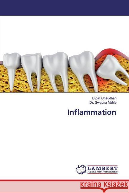 Inflammation Chaudhari, Dipali; Mahle, Dr. Swapna 9786139986057 LAP Lambert Academic Publishing - książka