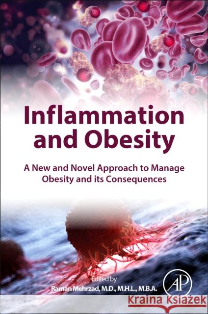 Inflammation and Obesity: A New and Novel Approach to Manage Obesity and Its Consequences Raman Mehrzad 9780323909600 Academic Press - książka