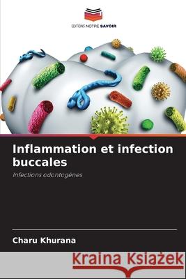 Inflammation et infection buccales Khurana, Charu 9786208712921 Editions Notre Savoir - książka