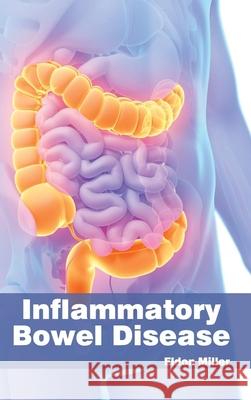 Inflammatory Bowel Disease Eldon Miller 9781632422453 Foster Academics - książka