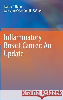 Inflammatory Breast Cancer: An Update Naoto T. Ueno Massimo Cristofanilli 9789400739062 Springer - książka