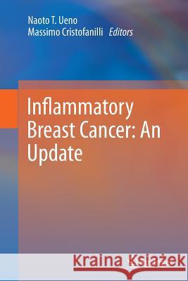 Inflammatory Breast Cancer: An Update Naoto T. Ueno Tamara Fink 9789400797727 Springer - książka