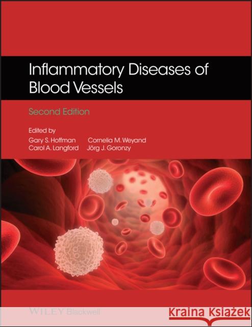 Inflammatory Diseases of Blood Vessels Gary S. Hoffman Cornelia M. Weyand Carol A. Langford 9781444338225 Wiley-Blackwell - książka