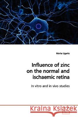 Influence of zinc on the normal and ischaemic retina Ugarte, Marta 9783639168693  - książka