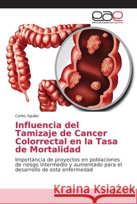 Influencia del Tamizaje de Cancer Colorrectal en la Tasa de Mortalidad Aguilar, Carlos 9786202153621 Editorial Académica Española - książka